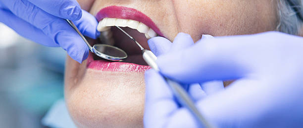 Best Emergency Treatment for Dental Infections or Abscesses in Mineola, TX